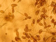 Alternaria Alternaria solani